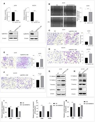 Knockdown of hnRNPA1 Promotes NSCLC Metastasis and EMT by Regulating Alternative Splicing of LAS1L exon 9